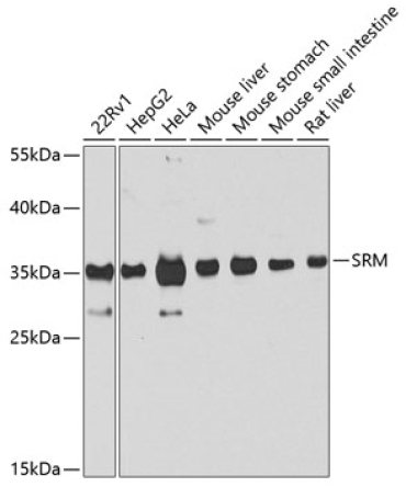SRM Rabbit Polyclonal Antibody