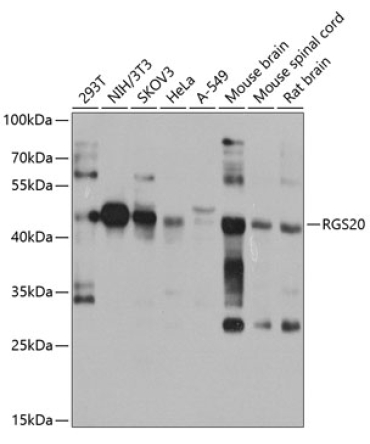 RGS20 Rabbit Polyclonal Antibody