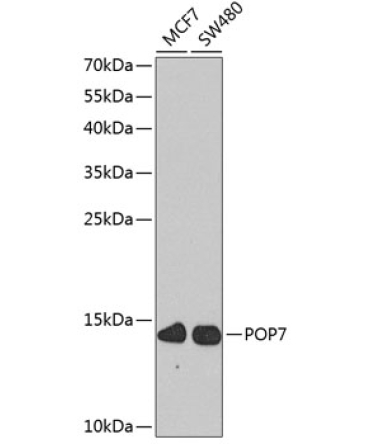 POP7 Rabbit Polyclonal Antibody