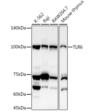 TLR6 Rabbit Polyclonal Antibody