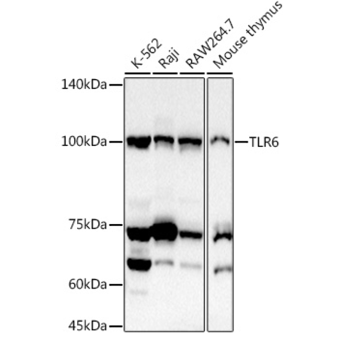 TLR6 Rabbit Polyclonal Antibody
