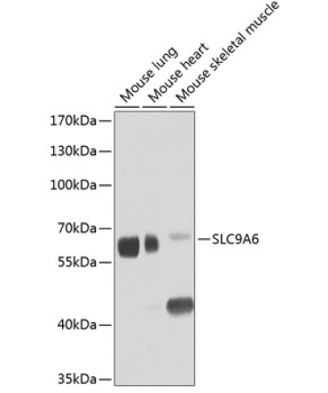 SLC9A6 Rabbit Polyclonal Antibody