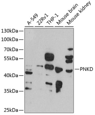 PNKD Rabbit Polyclonal Antibody