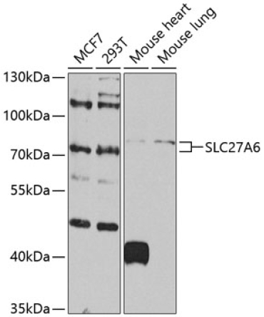 SLC27A6 Rabbit Polyclonal Antibody