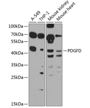 PDGFD Rabbit Polyclonal Antibody