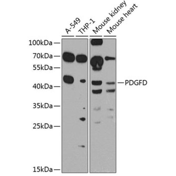 PDGFD Rabbit Polyclonal Antibody