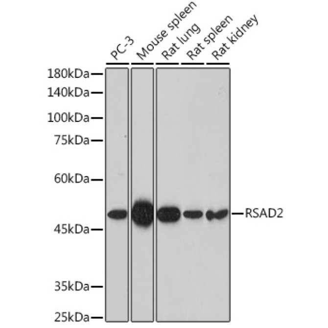 RSAD2 Rabbit Polyclonal Antibody