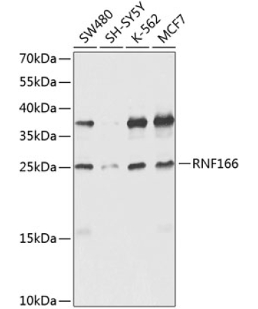 RNF166 Rabbit Polyclonal Antibody