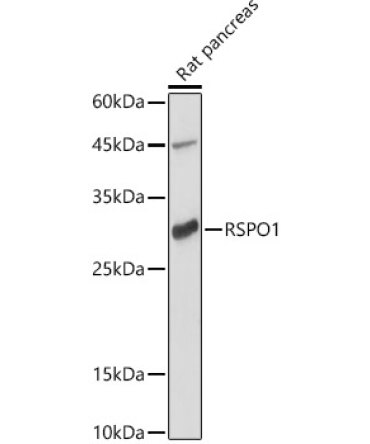RSPO1 Rabbit Polyclonal Antibody