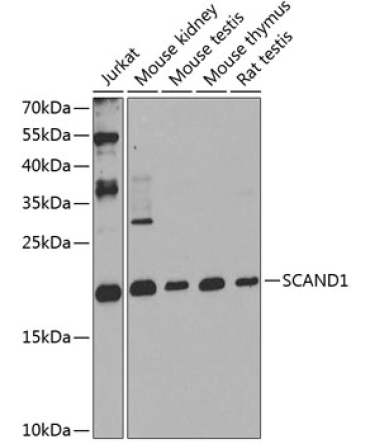 SCAND1 Rabbit Polyclonal Antibody