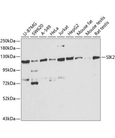 SIK2 Rabbit Polyclonal Antibody