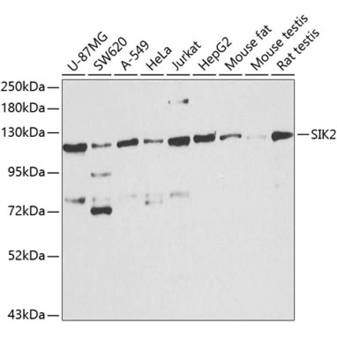 SIK2 Rabbit Polyclonal Antibody