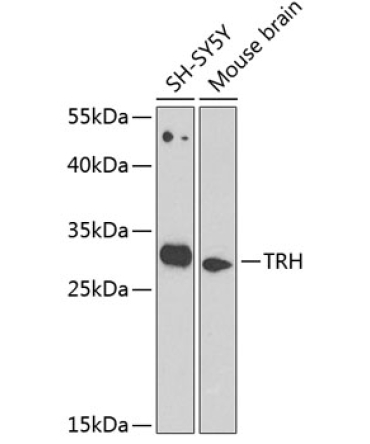 TRH Rabbit Polyclonal Antibody