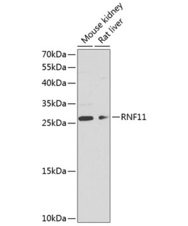 RNF11 Rabbit Polyclonal Antibody