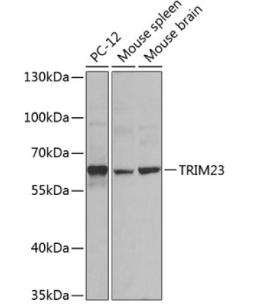 TRIM23 Rabbit Polyclonal Antibody