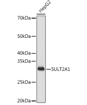 SULT2A1 Rabbit Monoclonal Antibody