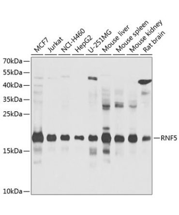 RNF5 Rabbit Polyclonal Antibody