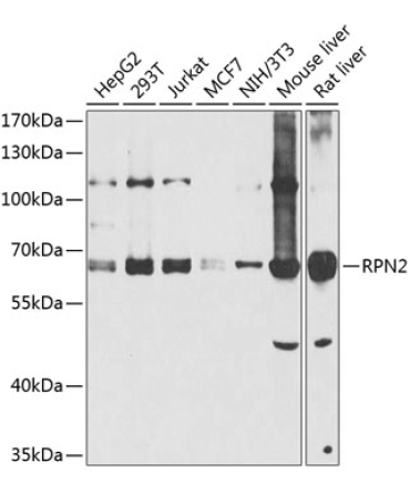RPN2 Rabbit Polyclonal Antibody
