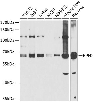 RPN2 Rabbit Polyclonal Antibody