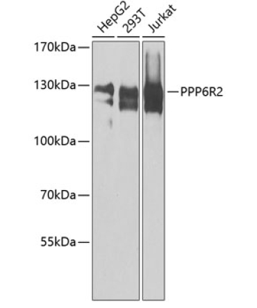 PPP6R2 Rabbit Polyclonal Antibody