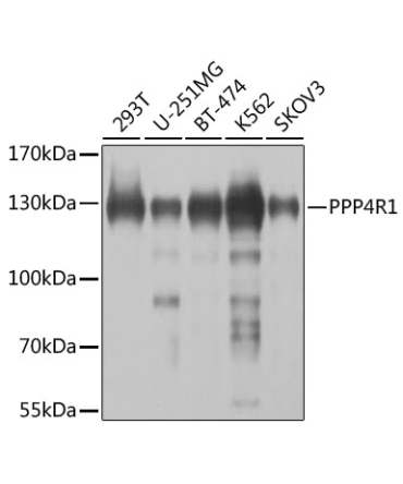 PPP4R1 Rabbit Polyclonal Antibody