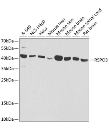 RSPO3 Rabbit Polyclonal Antibody