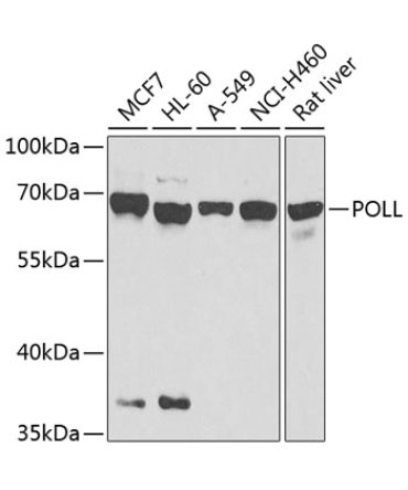 POLL Rabbit Polyclonal Antibody