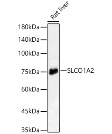 SLCO1A2 Rabbit Polyclonal Antibody
