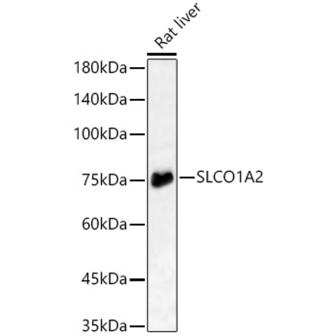 SLCO1A2 Rabbit Polyclonal Antibody