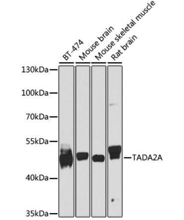TADA2A Rabbit Polyclonal Antibody