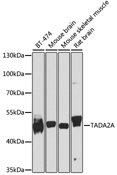 TADA2A Rabbit Polyclonal Antibody