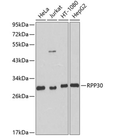 RPP30 Rabbit Polyclonal Antibody