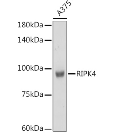 RIPK4 Rabbit Polyclonal Antibody