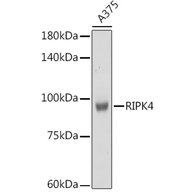 RIPK4 Rabbit Polyclonal Antibody