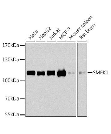 SMEK1 Rabbit Polyclonal Antibody