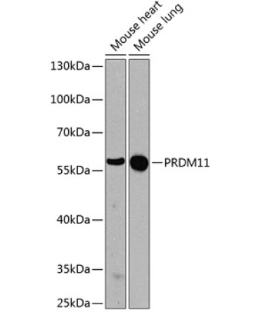 PRDM11 Rabbit Polyclonal Antibody