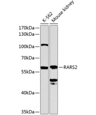 RARS2 Rabbit Polyclonal Antibody