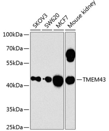 TMEM43 Rabbit Polyclonal Antibody