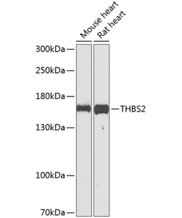 THBS2 Rabbit Polyclonal Antibody