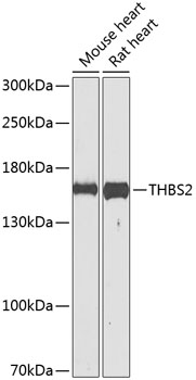 THBS2 Rabbit Polyclonal Antibody