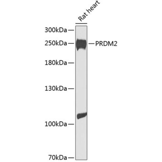 PRDM2 Rabbit Polyclonal Antibody