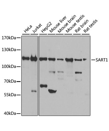 SART1 Rabbit Polyclonal Antibody