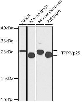 TPPP/p25 Rabbit Polyclonal Antibody