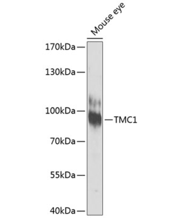TMC1 Rabbit Polyclonal Antibody