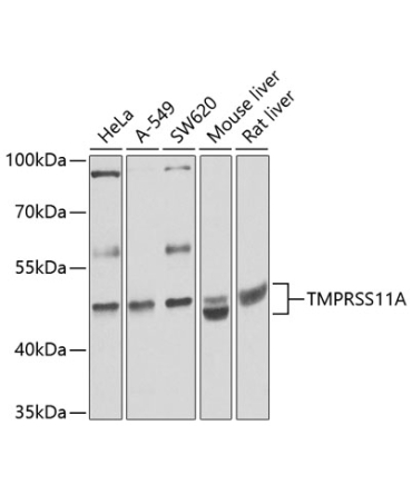 TMPRSS11A Rabbit Polyclonal Antibody