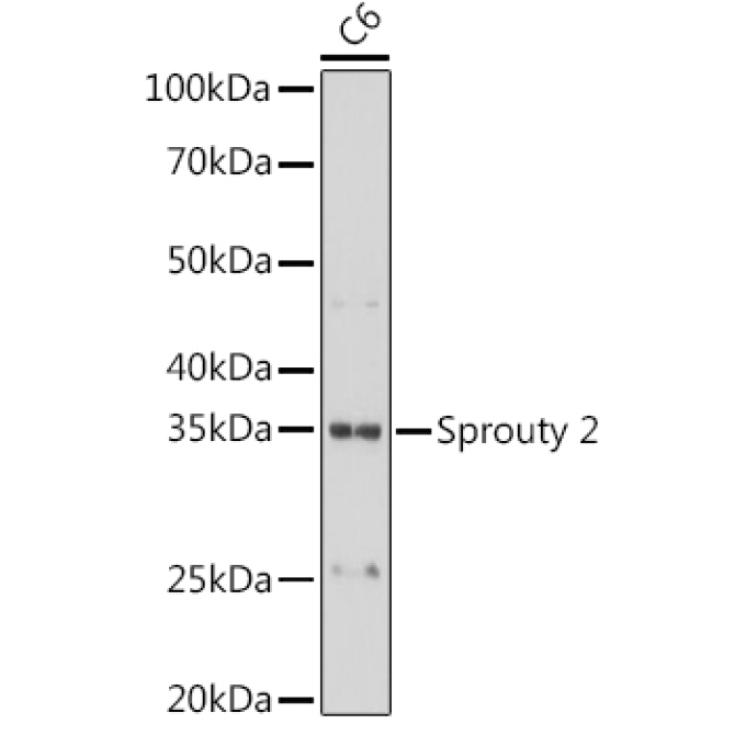 Sprouty 2 Rabbit Monoclonal Antibody