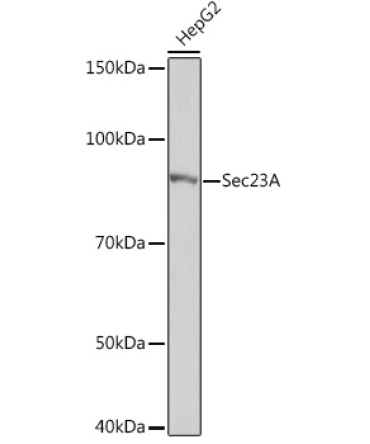 Sec23A Rabbit Monoclonal Antibody