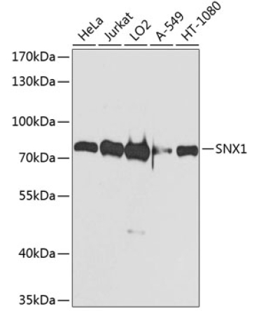SNX1 Rabbit Polyclonal Antibody