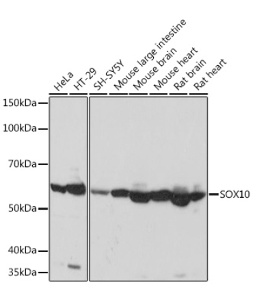 SOX10 Rabbit Monoclonal Antibody