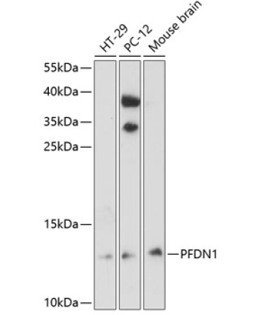 PFDN1 Rabbit Polyclonal Antibody